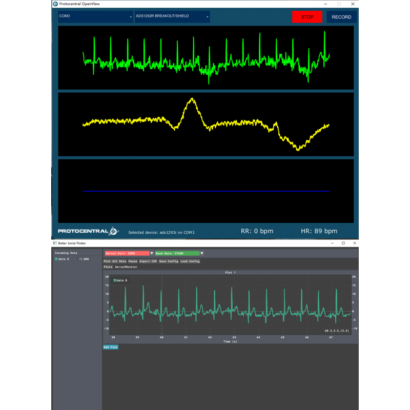 SNQP ADS1292 心电图传感器 双通道呼吸监测心率采集20电赛开发板 STM32套件 2代带隔离 计价单位:个 SNQP ADS1292 心电图传感器 双通道呼吸监测心率采集20电赛开发板 STM32套件 2代带隔离 计价单位:个